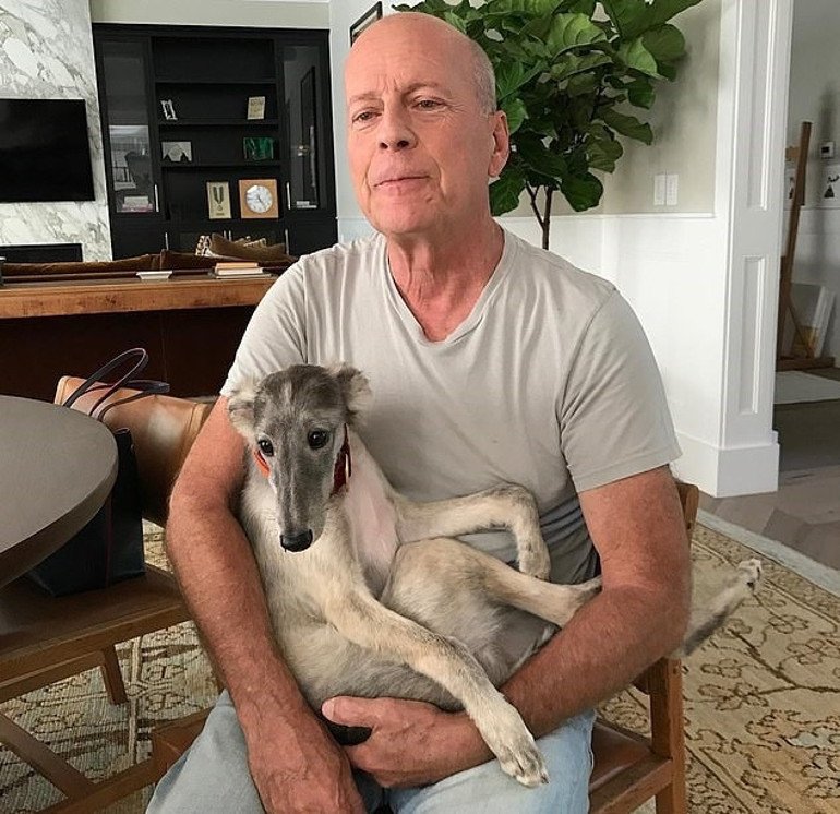 Bruce Willis’in Frontotemporal Demans Mücadelesi ve Emma Heming’in Bitmeyen Yas Hali