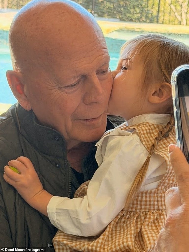 Bruce Willis’in Frontotemporal Demans Mücadelesi ve Emma Heming’in Bitmeyen Yas Hali